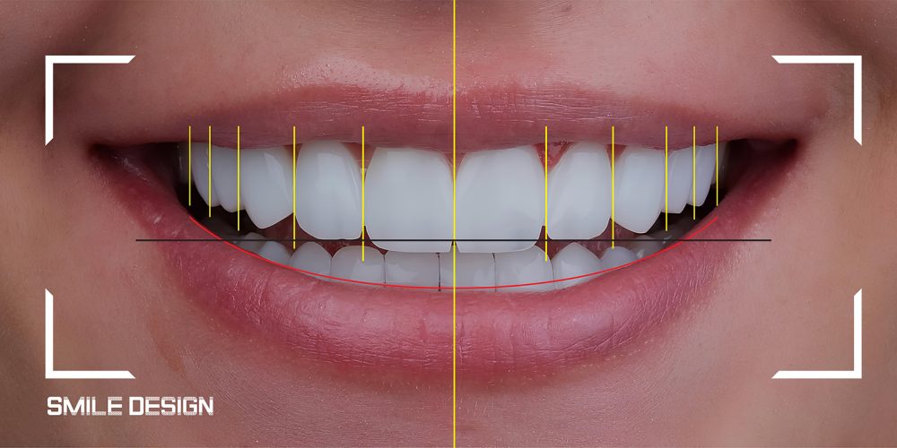 Odontoiatria integrata - Studio Medico Odontoiatrico Integrato Dr.ssa Lavinia Dolci