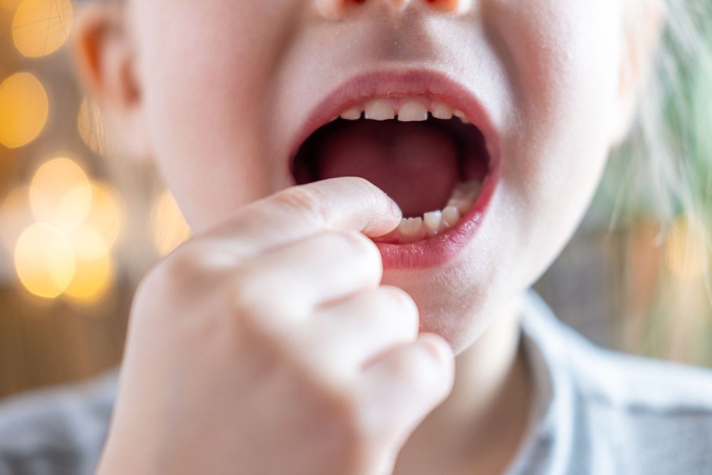 Bambini e neonati - Studio Medico Odontoiatrico Integrato Dr.ssa Lavinia Dolci