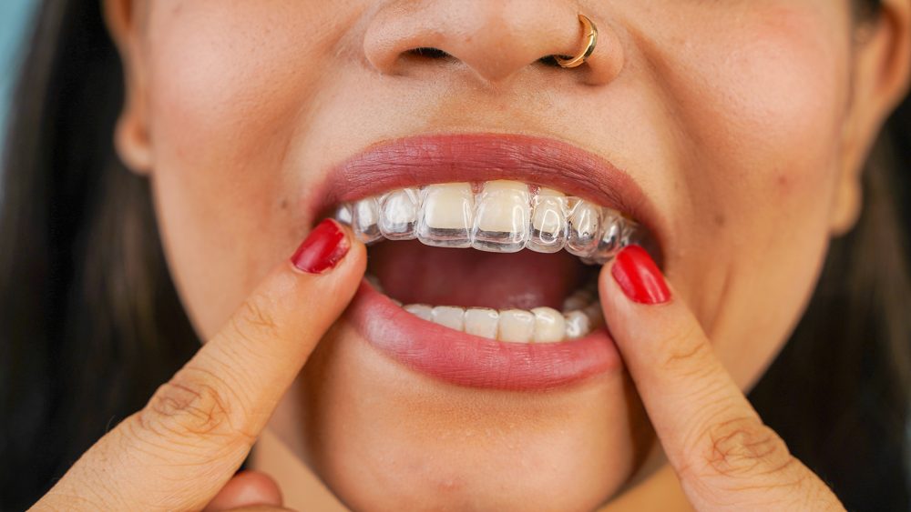 Odontoiatria integrata - Studio Medico Odontoiatrico Integrato Dr.ssa Lavinia Dolci