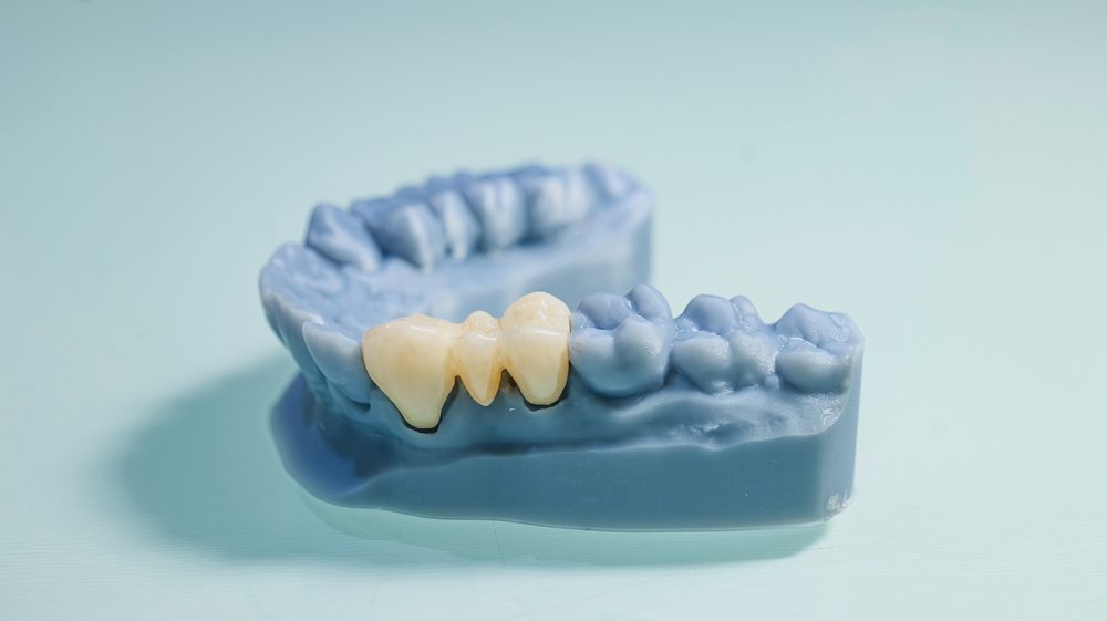 Anziani e terza età - Studio Medico Odontoiatrico Integrato Dr.ssa Lavinia Dolci