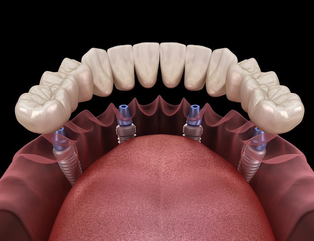 Anziani e terza età - Studio Medico Odontoiatrico Integrato Dr.ssa Lavinia Dolci