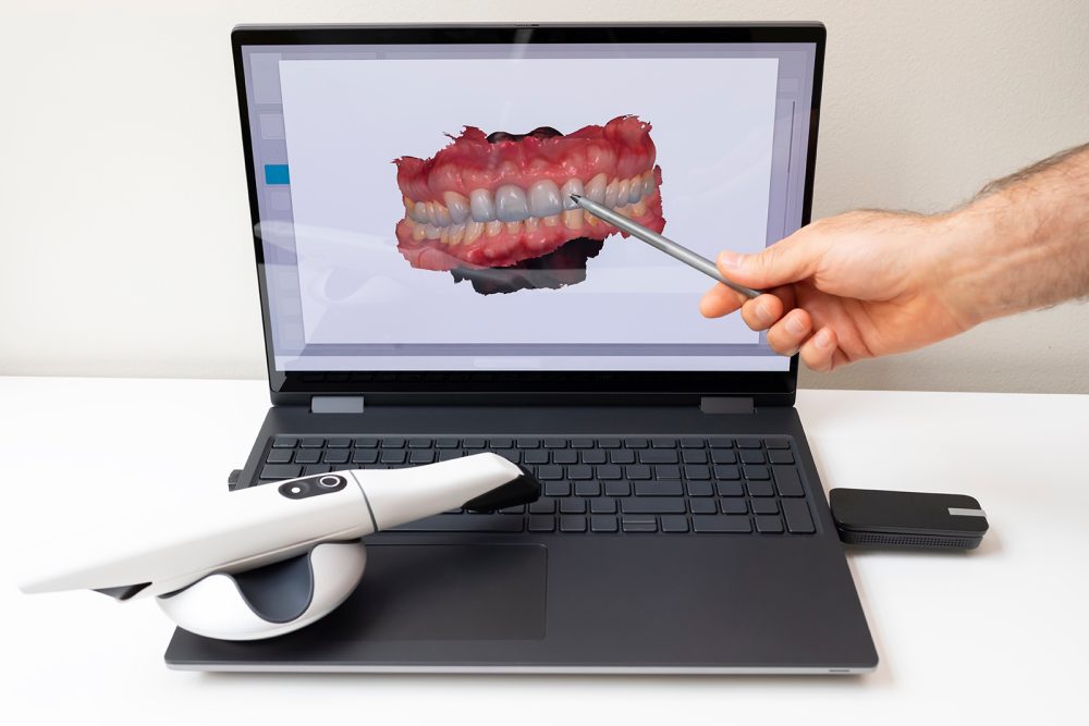 Scanner intraorale digitale - Studio Medico Odontoiatrico Integrato Dr.ssa Lavinia Dolci